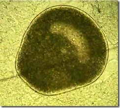 Ichthyo Wimperntierchen unter dem Microskop